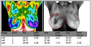 thermal-breasts