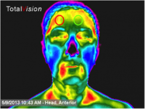 thermal-face